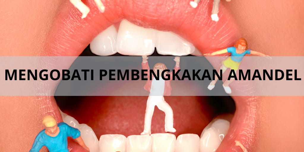 Mengobati Pembengkakan Amandel